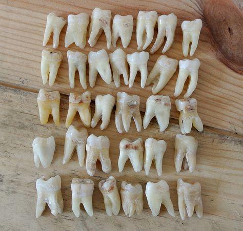 a little collection of human teeth molars Loose Tooth, Human Teeth, Dental Art, Natural Teeth Whitening, Budget Planer, Tooth Fairy, Teeth Whitening, Bones, Art Reference