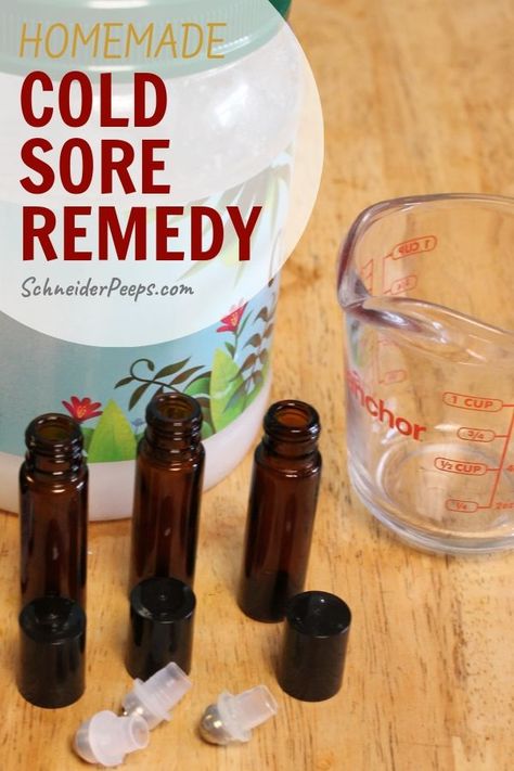 Essential Oils For Cold Sores On Lip, Essential Oils For Fever Blister, Cold Sore Remedy Overnight How To Get Rid, Essential Oil For Cold Sore On Lip, Diy Cold Sore Remedy Fast, Fever Blister Essential Oils, How To Get Rid Of Cold Sores Overnight, Essential Oils For Cold Sores, Cold Sore Remedy