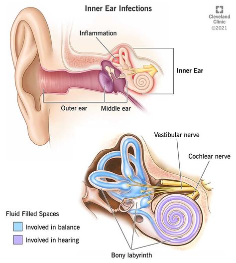 Inner Ear Infection: Symptoms, Signs & Causes Inner Ear Anatomy, Ear Drainage, Eustachian Tube Dysfunction, Neurological Assessment, Ear Anatomy, Outer Ear, Middle Ear, Ear Infections, Medical Wallpaper