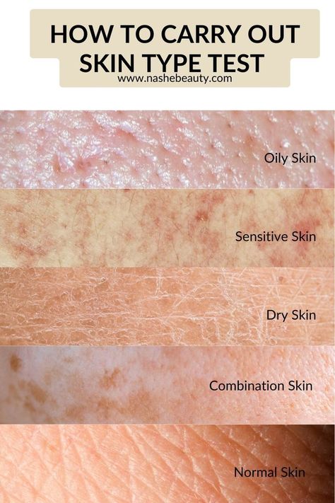 #Wellness #HealthyLiving #NutritionTips #FitnessTips #HealthTips #HealthyLifestyle #SelfCare #FitLife Skin Types Chart, Skin Type Test, Skin Anatomy, Blind Pimple, Skin Facts, Acne Overnight, Skin Aesthetics, Natural Acne Remedies, Facial Skin Care Routine