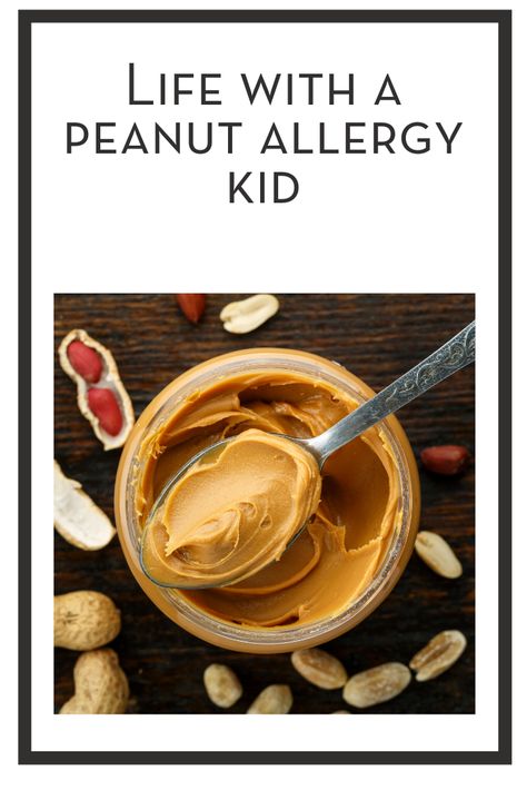 To the parents who don’t understand the severity of a peanut allergy (or any other life-threatening allergy), this is for you. Peanut Allergy Snacks, Peanut Allergy Awareness, Food Allergies Awareness, Tree Nut Allergy, Dairy Allergy, Kids Allergies, Allergy Awareness, Gluten Allergy, Liver Diet