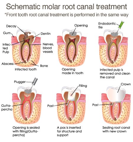 #SugarFixDentalLoft Dentist Clinic, Remedies For Tooth Ache, Dental Posters, Dental Braces, Dental Fun, Root Canal, Dental Services, Oral Health Care, Dental Clinic