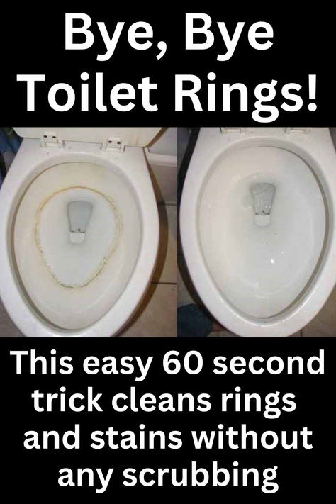 "Lazy Moms" toilet cleaning trick cleans the whole bowl in 60 seconds without any scrubbing at all. Toilet Bowl Stains, Toilet Cleaning Hacks, Toilet Ring, Easy House Cleaning, Toilet Stains, Diy Tips And Tricks, Clean Toilet Bowl, Household Help, Easy Cleaning Hacks