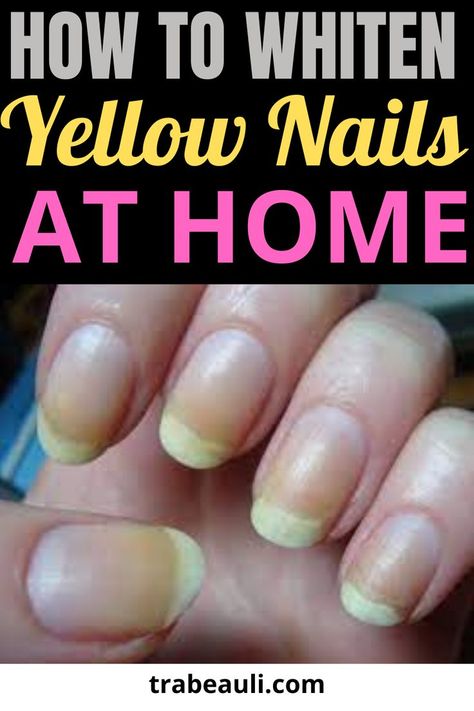 nail art How To Whiten Nails, Make Nails White, Stained Nails, Natural Nail Tips, Nail Whitening, Nail Remedies, Nail Care Diy, May Nails, Nail Care Routine