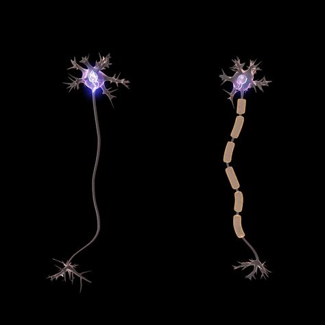 The key difference between myelinated and unmyelinated nerve fibres is that the myelinated nerve fibres have myelin sheaths around them while the unmyelinated nerve fibres do not have the sheath. Furthermore, the nerve impulse transmission is faster in myelinated nerve fibers while it is slower in unmyelinated nerve Basic Anatomy And Physiology, Nerve Fiber, Biology Facts, Biology Lessons, Medical School Motivation, Biology Notes, Medical Anatomy, Nerve Cell, Medical Knowledge