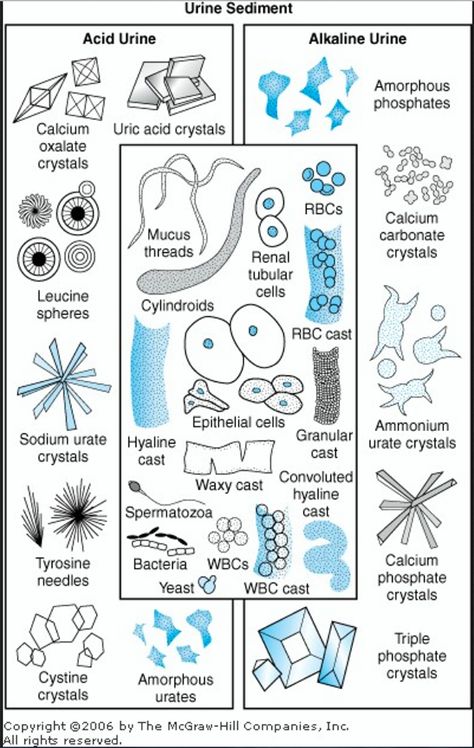 Urine Sediment chart #VetTechLife Medical Lab Technician Study, Histopathology Lab, Med Lab Tech, Urine Microscopy, Medical Lab Technician, Vet Tech School, Veterinary Tech, Vet Tech Student, Medical Laboratory Technician