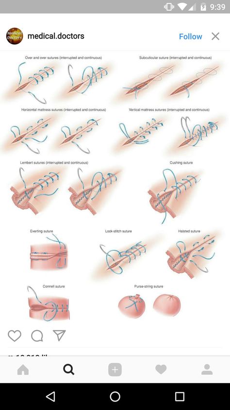 Stitches Medical, Surgical Stitches, Medical Terminology Study, Medical School Life, Vet Medicine, Medical Student Motivation, Surgical Nursing, Medical Student Study, Nursing School Survival