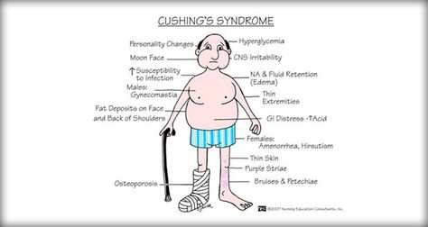 Cushing syndrome or cushing's syndrome results from excessive adrenocortical activity. Nursing care plans available here. Cushings Syndrome, Nursing Board, Nurse Manager, Nursing Mnemonics, Nursing School Survival, Musculoskeletal System, Nursing School Studying, Nursing School Tips, Medical School Studying