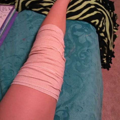 Fell off my bike got my leg hurt bruses and scawers and lip and eye swallon i fell off of it preety hard Leg Fracture Snapchat, Leg Bandage Snapchat, Broke Leg Snapchat, Bandaged Hands, Eating Food Funny, Shower Pics, Leg Injury, Pretty Pens, Hand Photo