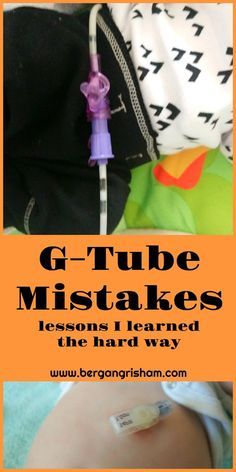 When my baby got a g-tube, I knew I had a lot to learn. I made a lot of mistakes before I got the hang of things. Hopefully someone can learn from my g-tube mistakes! Peg Feeding Tube, Ng Tube Baby Hacks, G Tube Organization, Tube Feeding Hacks, G Tube Feeding, Tube Feeding Nursing, Gtube Feeding Hacks, G Tube Hacks, Feeding Tube Hacks