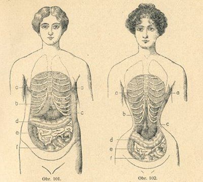 Wasp waist. Image from Nové Domácí Léčení, date unknown.Goal is 18 inch waist. Wasp Fashion, Womens Anatomy, Waist Drawing, Anatomical Drawings, Wasp Waist, Class Presentation, Gross Anatomy, Female Hysteria, Medical Anatomy