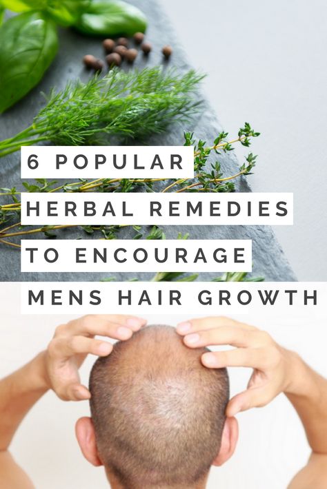 Hair Growth Tips For Men Natural, Hair Growth For Men Remedies, Men’s Hair Growth, Hair Lossing Tips Men, Hair Growth Tips For Men, Mens Hair Growth, Hair Regrowth For Men, Men Hair Growth, Natural Hygiene