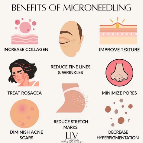 With all of these great benefits, why haven't you tried Microneedling yet???? 🤔 #medspa #microneedling #skincare #selfcare Skin Care Treatments Faces, Self Care Treatments, Microbrasion Facial, Microneedling Marketing, Rf Microneedling Benefits, Med Spa Instagram Post, Micro Needling Benefits, Microneedling After Care, Microneedling Aesthetic