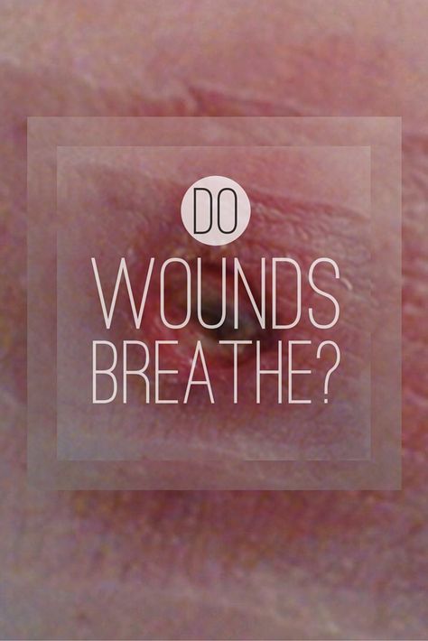 The Battle of Wound Healing: Dry vs. Moist Wound Healing Nursing, Natural Wound Care, Blood Blister, Heal Wounds Faster, Wound Care Dressings, Wound Care Nursing, Nurse Teaching, Abdominal Surgery, Oncology Nursing