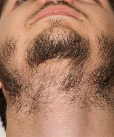 Tired of having a patchy beard? Learn how to fix and grow out bald spots in your beard with pro tips on styling, trimming, nutrition, and beard growth products. Facial Hair Growth For Men, Patchy Beard Styles For Men, Trimmed Beard Styles, Patchy Beard Styles, Bald Beard, Beard Growth Tips, Beard Maintenance, Growing Facial Hair, Guys Grooming