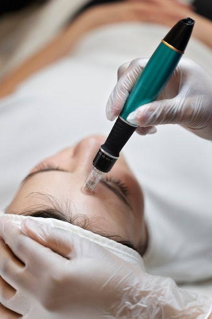 Free photo person getting micro needling... | Free Photo #Freepik #freephoto #microneedling #collagen #cosmetics-collagen #cosmetics-beauty Microneedling Video, Micronidelling Face, Microneedling Aesthetic, Esthetics Photos, Facial Photos, Dermapen Microneedling, Facial Pictures, Spa Aesthetic, Skin Needling