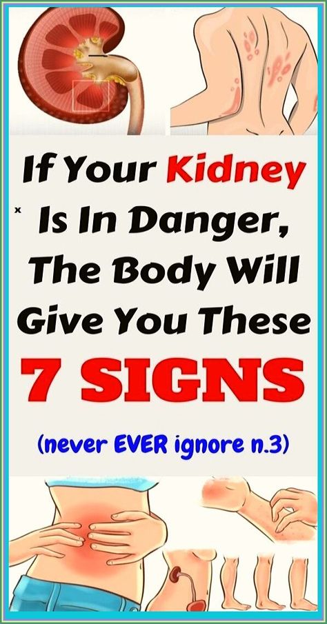 If Your Kidneys Are In Danger, Your Body Will Give You These 7 Signs Womens Health Care, Kidney Health, Health Facts, Healthy Tips, Holistic Health, Womens Health, Healthy Habits, Home Remedies, Natural Remedies