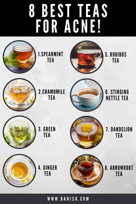 Teas For Acne, Diy Detox Tea, Lemon Tea Benefits, Nettle Tea, Ginger Tea Benefits, Best Teas, Spearmint Tea, Tea Remedies, Dandelion Tea