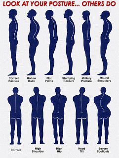 Mr. E's Singing Page Posture Fix, Fix Your Posture, Posture Exercises, Yoga Beginners, Spine Health, Bad Posture, Body Posture, Better Posture, Chiropractic Care