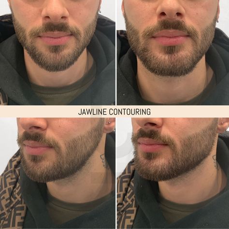 Jawline Workout, Define Jawline, Jawline Tips, Jawline Men, Jawline Contouring, Jawline Filler, Jawline Exercise, Chiseled Jawline, Strong Jawline