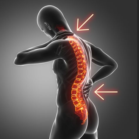 Types of Spine Curvature Disorders - Spine Institute of Arizona Lumbar Lordosis, Body Aches, Marketing Words, Spine Surgery, Body Ache, Poor Posture, Medical Knowledge, Young Professional, Natural Curves