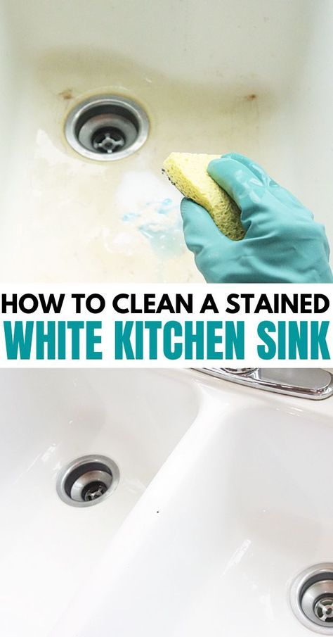 Clean White Sink, Clean Porcelain Sink, Enamel Sink, Kitchen Sink Cleaner, How To Bleach Whites, White Farm Sink, Porcelain Kitchen Sink, Remove Yellow Stains, Farmers Sink