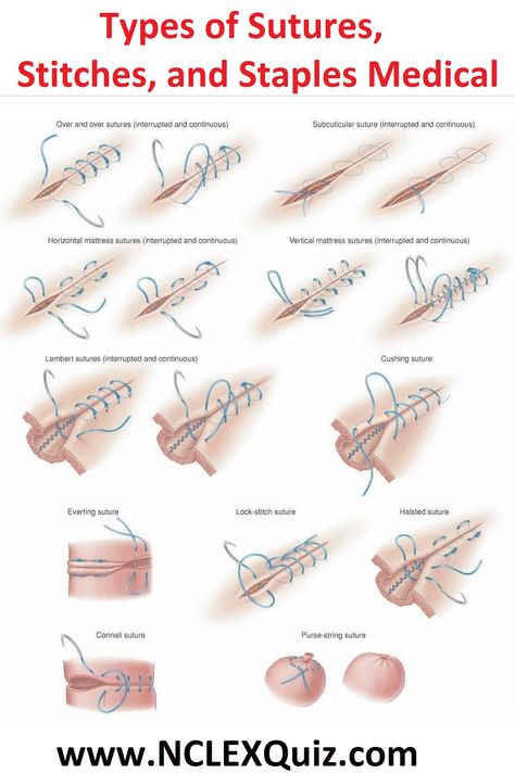 Suture Types, Surgical Suture, Vet Medicine, Medical Student Study, Surgical Tech, Nursing School Survival, Nursing School Studying, Nursing School Tips, Nursing School Notes