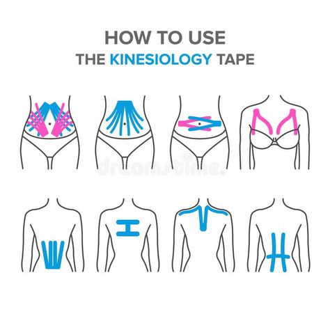 Physio Tape, K Tape, Kinesio Tape, Kt Tape, Kinesio Taping, Physical Therapy Exercises, Kinesiology Taping, Muscle Anatomy, Medical Anatomy