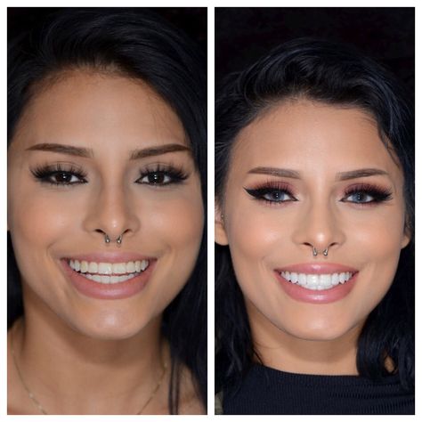 Things to know before you get veneers. Veneer Shapes Teeth, Natural Looking Veneers Teeth, Celebrity Smiles Teeth, Front Teeth Veneers Before And After, Beautiful Teeth Shape, Best Veneers Teeth, Hollywood Smile Veneers, Pop On Veneers Before And After, Teeth Implants Before And After