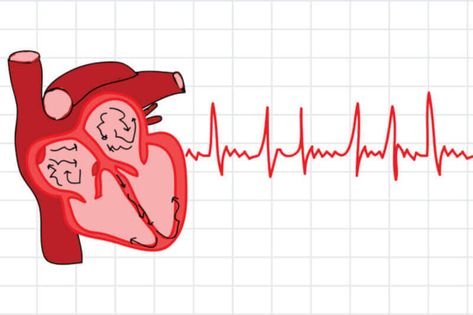 Afib Atrial Fibrillation, Normal Sinus Rhythm, Cardiac Rhythms, Atrial Fibrillation, Coronary Arteries, Vagus Nerve, Low Impact Workout, Aerobic Exercise, Heart Health