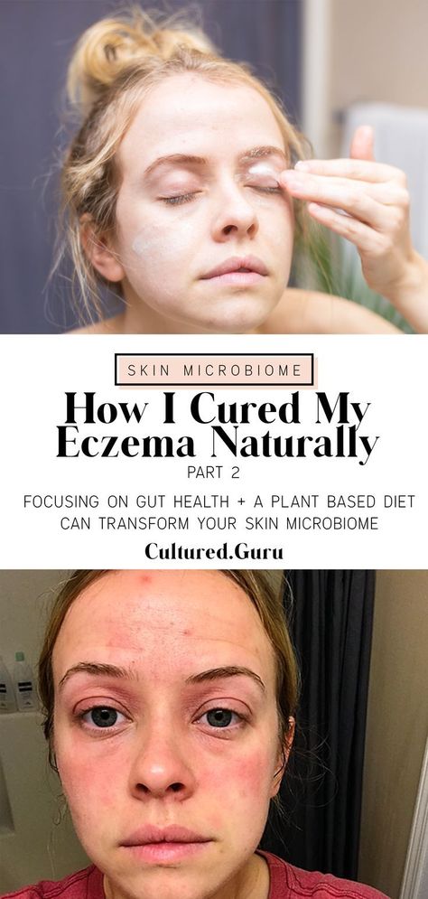 Skin Diet, Natural Skin Care Routine, Oily Skin Care, Vegan Meals, Skin Routine, Raw Food, Healthy Skin Care, Plant Based Diet, Gut Health