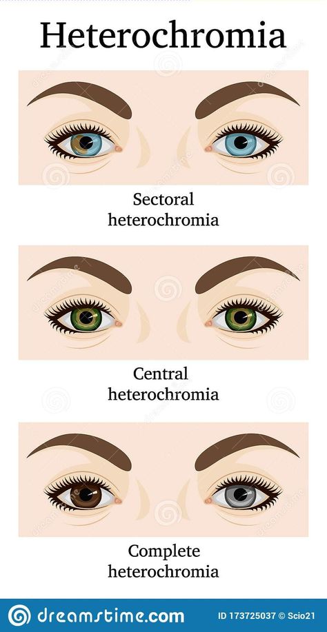 Sectoral Heterochromia, Central Heterochromia, Heterochromia Eyes, How To Draw Eyelashes, Hazel Green Eyes, Novel Characters, Aesthetic Eyes, Eye Design, Pretty Eyes