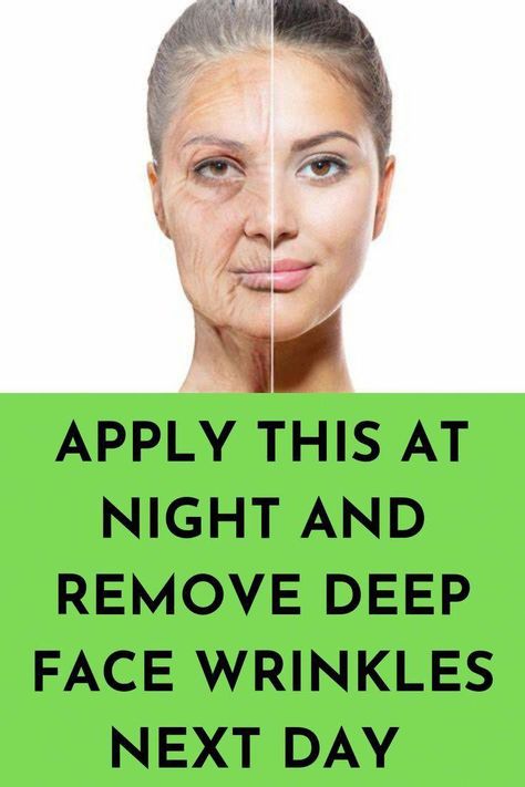 Home Remedies For Wrinkles, Anti Aging Remedies, Homemade Wrinkle Cream, Eye Wrinkles, Wrinkle Remedies, Wrinkle Free Skin, Neck Wrinkles, Natural Anti Aging, Glow Skin