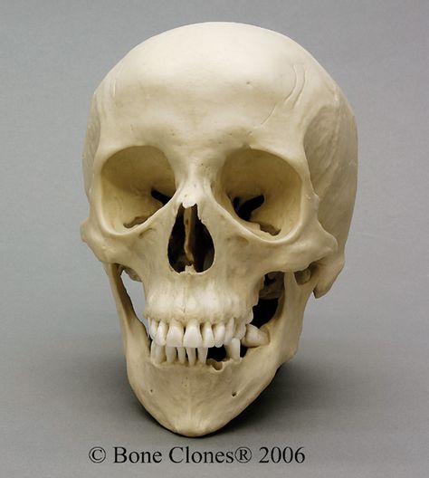 Human Female Skull with Down syndrome Anatomical Skull, Anatomy Studies, Skull Anatomy, Skull Reference, Skull Sculpture, Male Figure Drawing, Real Skull, Indian Skull, Oldest Human