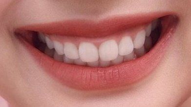 V34 Colour Corrector, Teeth Aesthetic, Pretty Teeth, Colour Corrector, Windows To The Soul, Whitening Teeth, Beautiful Teeth, Gummy Smile, Perfect Teeth