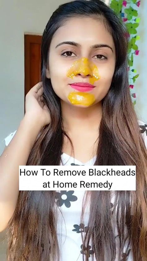 Destroy Your Moles, Warts, Blackheads, Skin tags and Age Spots Completely NaturallyFor Detail Watch Complete Video. Stay healthy and active! Share and make y... Moles On Face, Remove Moles, Skin Moles, Face Skin Care Routine, Natural Skin Care Remedies, Diy Skin Care Routine, Natural Face Skin Care, Good Skin Tips, Skin Tags