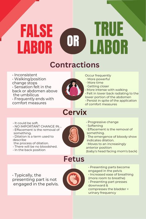 Understanding False vs True Labor: What You Need to Know Stages Of Labor Nursing Notes, Nursing School Labor And Delivery, Labor And Delivery Nursing School Notes, Midwifery Nursing Notes, Obgyn Study Notes, Labor And Delivery Notes, Labor And Delivery Cheat Sheets, Midwife Study Notes, Neonatal Nurse Notes