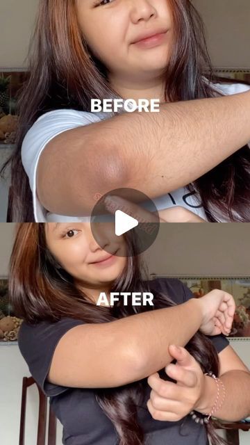 Pihu officials on Instagram: "Get Rid of Dark Elbow/Knees Naturally   . . . #darkelbows #dark #viralreels #trandingreels #skincareblogger #skincare #darkknees #darkelbowandknees #instagramreels #instagood" How To Get Rid Of Ashy Knees And Elbows, Dark Elbows Remedies, How To Get Rid Of Dark Knees And Elbows, Dark Elbows How To Get Rid Of, Dark Knees And Elbows Remedies, How To Get Rid Of Dark Knees, Dark Knees Remedy, Knee Whitening, Elbow Whitening