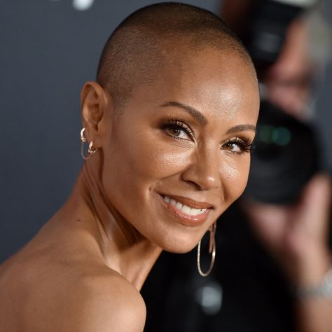 Bald Patches, Jada Pinkett, Willow Smith, Diy Kosmetik, Bald Hair, Regrow Hair, Bald Women, Jada Pinkett Smith, Demi Moore