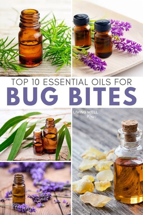 The 10 best essential oils for bug bites for soothing and relieving itchy mosquito, gnats, flies, and other irritating insect bites. Plus an easy DY essential oil roller blend recipe using lavender, tea tree, and other essential oils #rollerblend #bugbites #essentialoils Essential Oils For Bug Bites, Oils For Bug Bites, Essential Oils Bug Bites, Essential Oils For Mosquitoes, Mosquito Bite Relief, Itchy Bug Bites, Remedies For Mosquito Bites, Bug Bite Relief, Using Lavender