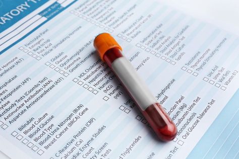 A geriatrician explains the 10 blood tests she orders the most, & why. Learn how these tests are often used, & what questions to ask about the results. Bat Women, Blood Test Results, Blood Work, Pathology Lab, Vision 2024, Medical Lab, Hdl Cholesterol, Medical Tests, White Blood Cells