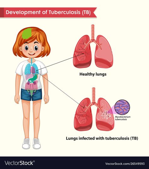 Liver Anatomy, Lung Anatomy, Human Lungs, Medical App, Healthy Lungs, Health Icon, Human Body Anatomy, Human Body Systems, Muscle Anatomy