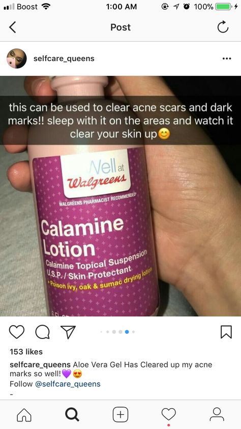 Calamine Lotion For Acne, Calamine Lotion, Dark Mark, Pharmacist, Shampoo Bottle, Lotion, Acne, Personal Care, Skin