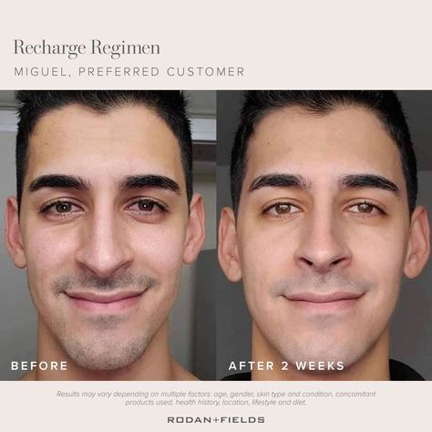 RECHARGE REGIMEN 😊Created for those in their 20's. Their skin was being constantly bombarded with environmental toxins and the increased stress that impacts the quality of the skin. 😊Boost the skins natural defenses and reveal your healthiest-looking skin now and in the future. #detoxyourskin #balanceskintone #boostskindefensesystem https://samanebayatkandi.myrandf.com/our-story/explore-our-regimens?utm_medium=rfsocial&utm_source=pinterest&utm_content=real-results%7Cbefore-afters Real Skin, Life Changing Skincare, Premium Skincare, Skin Aging, Lack Of Sleep, Real Results, Skin Issues, After Photos, Rodan And Fields