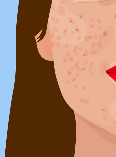 Body Positivity Art, How To Get Rid Of Pimples, Beauty Posters, Illustration Art Girl, 수채화 그림, Beauty Illustration, Feminist Art, Art And Illustration, Simple Skincare