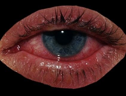 Crying Eyes, Scene Girl, Aesthetic Eyes, Arte Inspo, Lip Fillers, Eye Art, Pretty Eyes, Photo Reference, An Eye