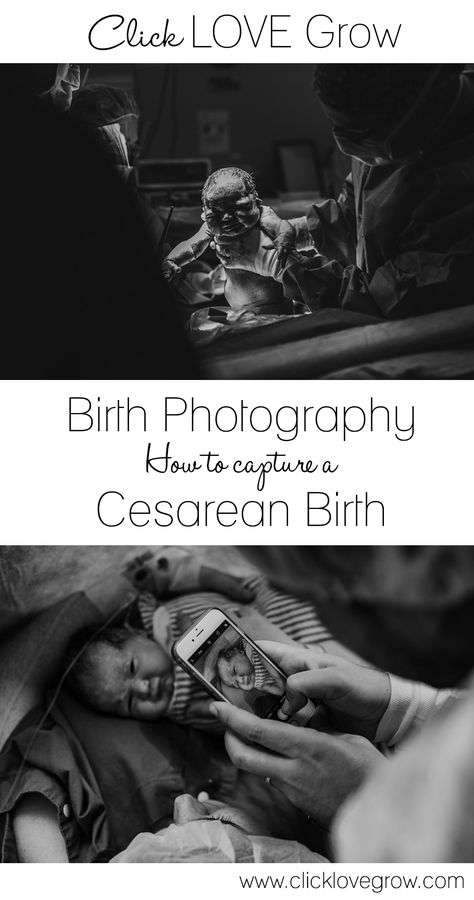 Cesarean Section Photography, C Section Birth Photography, C Section Photography, Newborn Lighting, Birth Photography Tips, Infant Photos, Birth Worker, Birth Pictures, Newborn Photography Tips