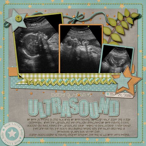 Ultrasound Scrapbook, Scrapbook Baby Book Ideas, Baby Boy Scrapbook Layouts, Pregnancy Scrapbook, Boy Scrapbook Layouts, Baby Scrapbook Album, Baby Ultrasound, Book Scrapbook