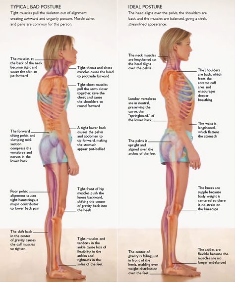 Posture Fix, Bolesti Chrbta, Workout Bauch, Posture Exercises, Coconut Health Benefits, Bad Posture, Poor Posture, Posture Correction, Muscle Aches