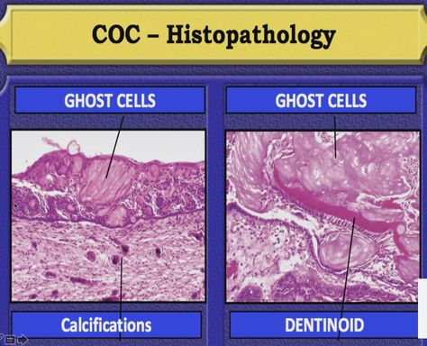 Oral Pathology